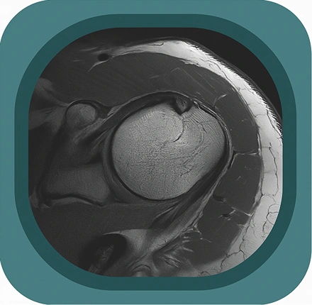 MRI shoulder ligaments anatomy icon